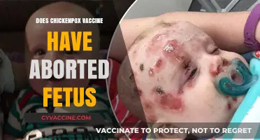 Chickenpox Vaccine and Aborted Fetus: Separating Fact from Fiction