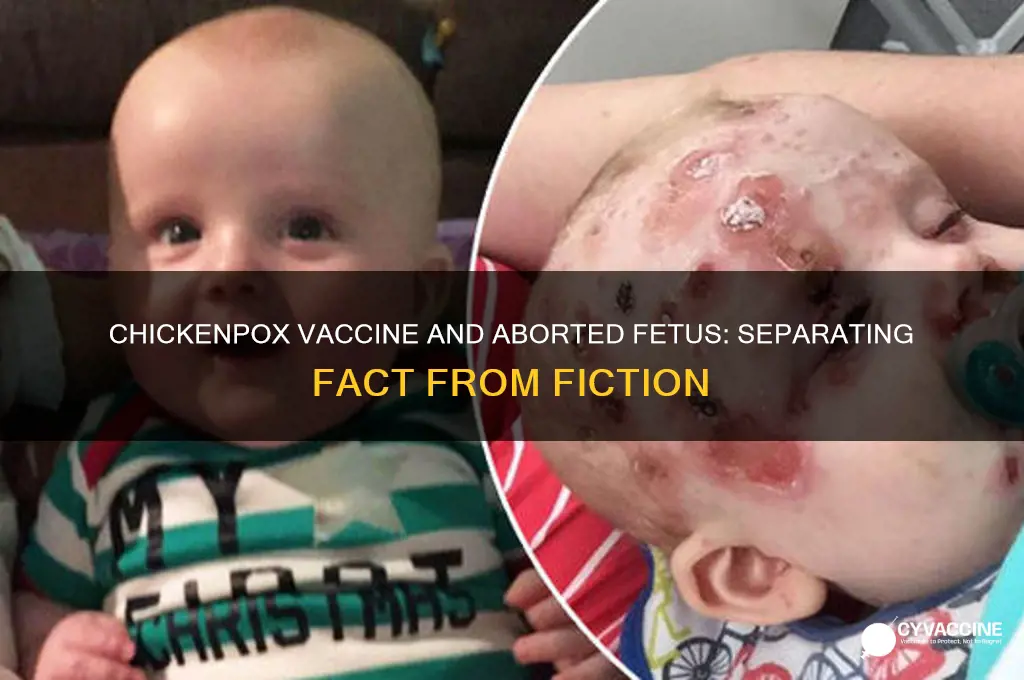 does chickenpox vaccine have aborted fetus