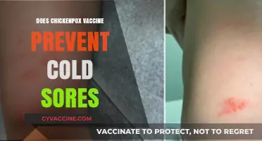 Chickenpox Vaccine and Cold Sores: Unraveling the Connection