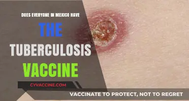 Tuberculosis Vaccine in Mexico: Who Gets Vaccinated?