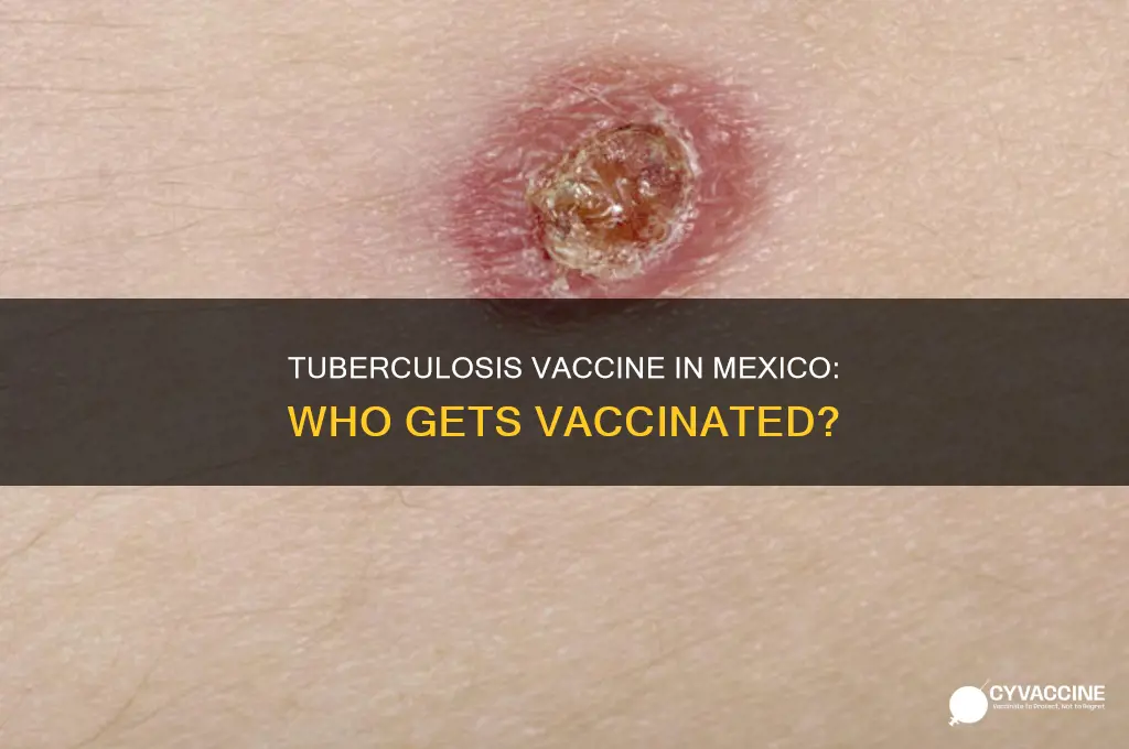 does everyone in mexico have the tuberculosis vaccine