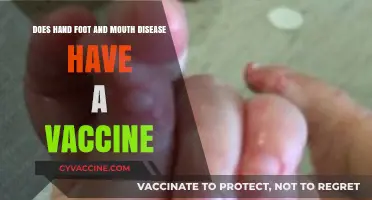 Hand, Foot, and Mouth Disease: Is There a Vaccine?