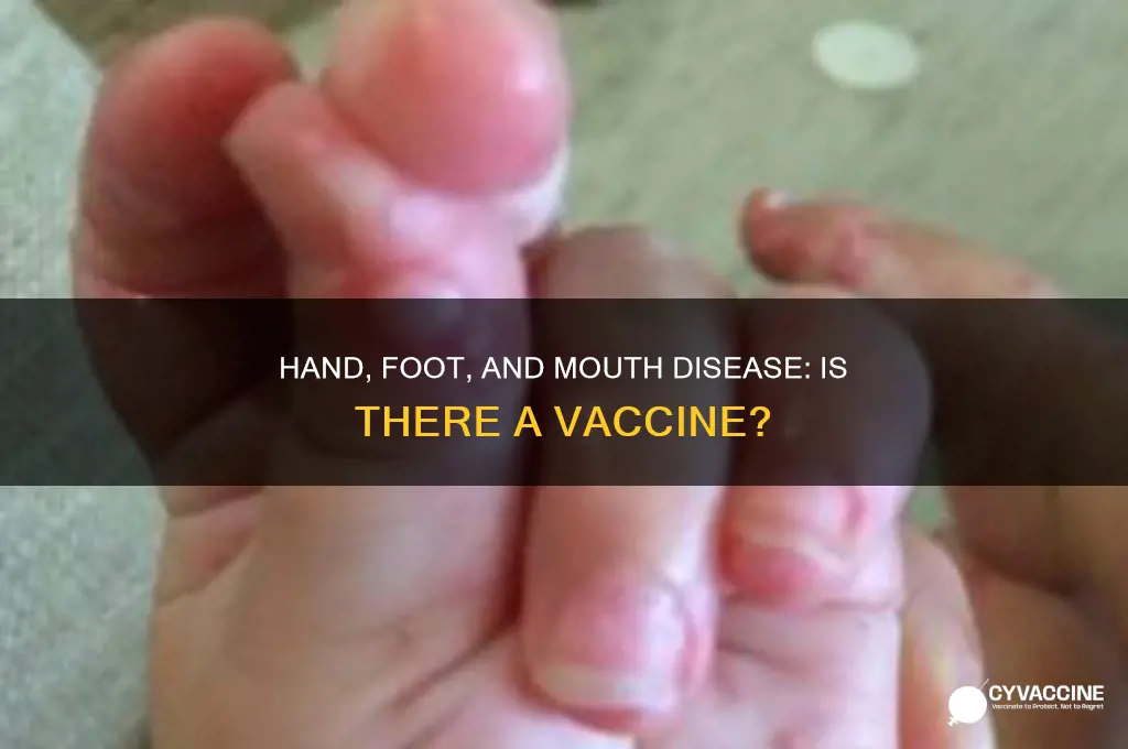 does hand foot and mouth disease have a vaccine