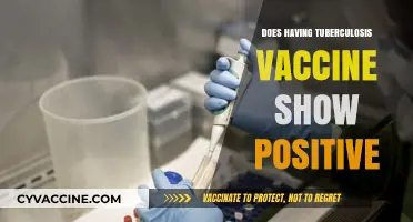 Can Tuberculosis Vaccination Cause False Positive TB Test Results?