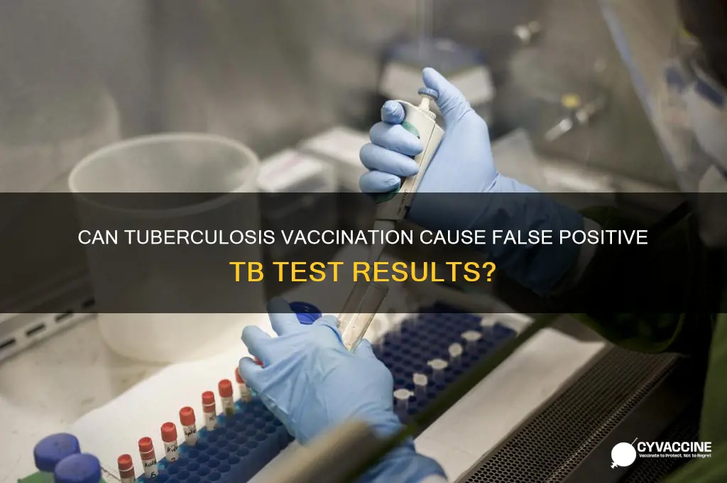 does having tuberculosis vaccine show positive