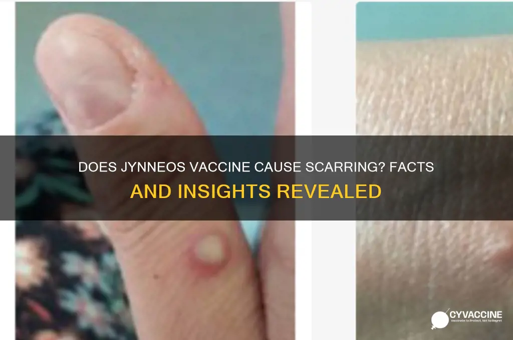 does jynneos vaccine leave a scar
