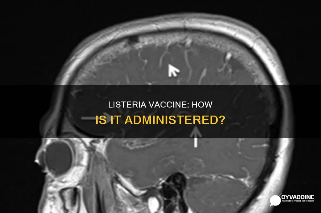 does listeria have a vaccine how is the vaccine administered