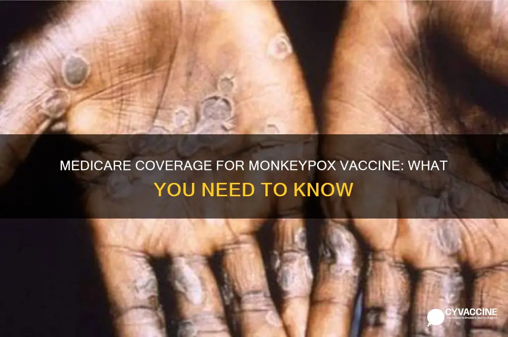 does medicare pay for monkeypox vaccine