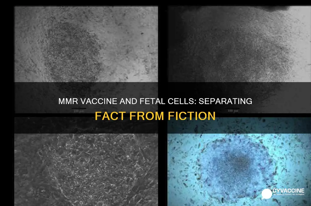 does mmr vaccine contain fetal cells