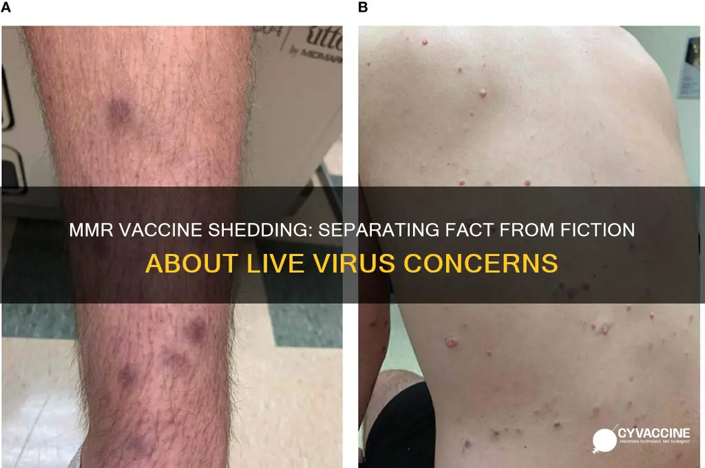 does mmr vaccine shed live virus