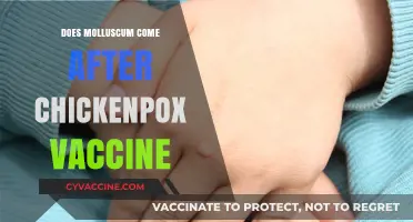 Molluscum Contagiosum Post-Chickenpox Vaccine: Unraveling the Connection