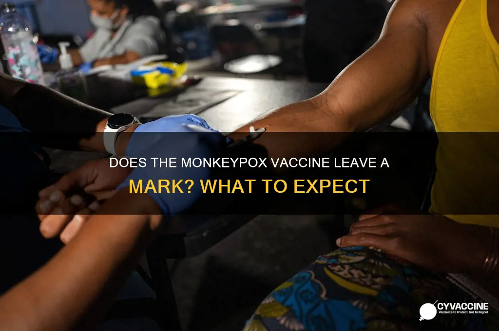 does monkeypox vaccine leave a mark