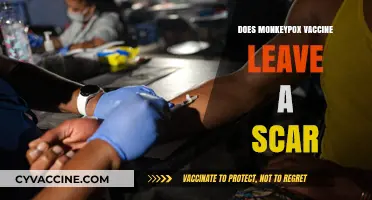 Monkeypox Vaccine: Scar Formation and What to Expect