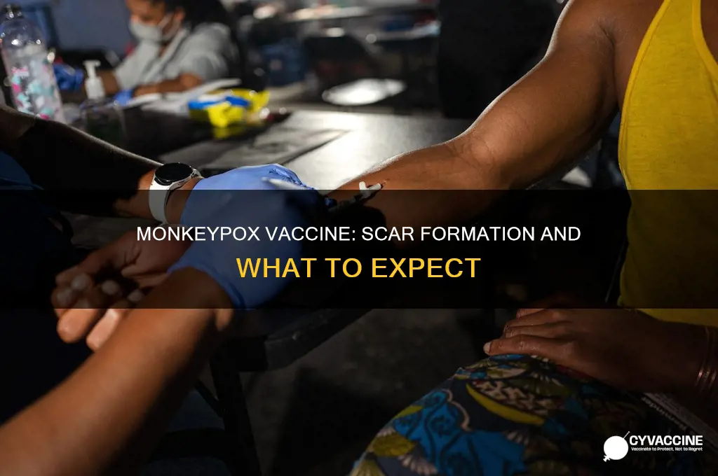does monkeypox vaccine leave a scar