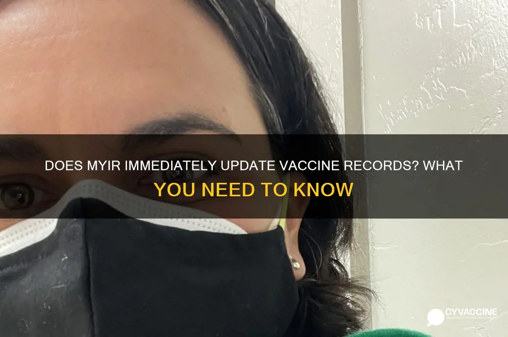 does myir update vaccine right away