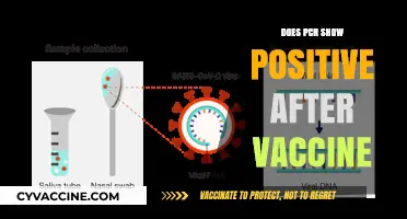 Can COVID-19 Vaccines Cause False Positive PCR Test Results?