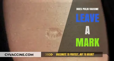 Polio Vaccine Scar: Does the Injection Leave a Visible Mark?