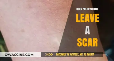 Polio Vaccine Scar: Fact or Fiction? Uncovering the Truth