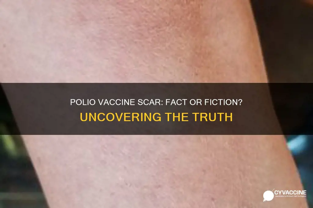 does polio vaccine leave a scar