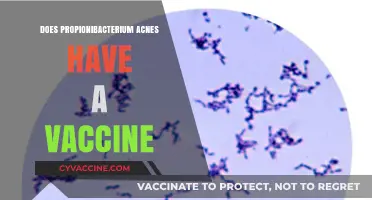 Exploring the Possibility of a Propionibacterium Acnes Vaccine