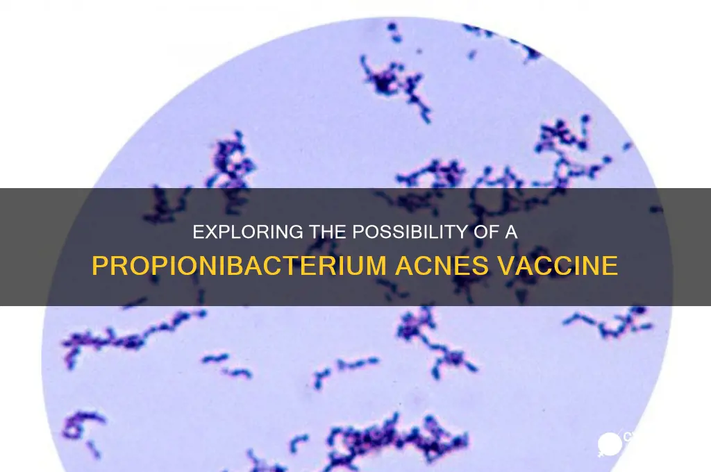 does propionibacterium acnes have a vaccine