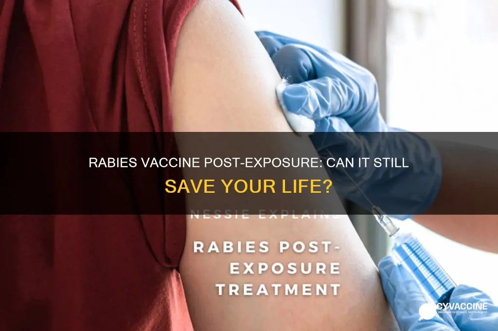 does rabies vaccine help after exposure