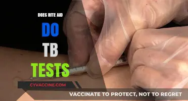 Does Rite Aid Offer TB Tests? A Comprehensive Guide