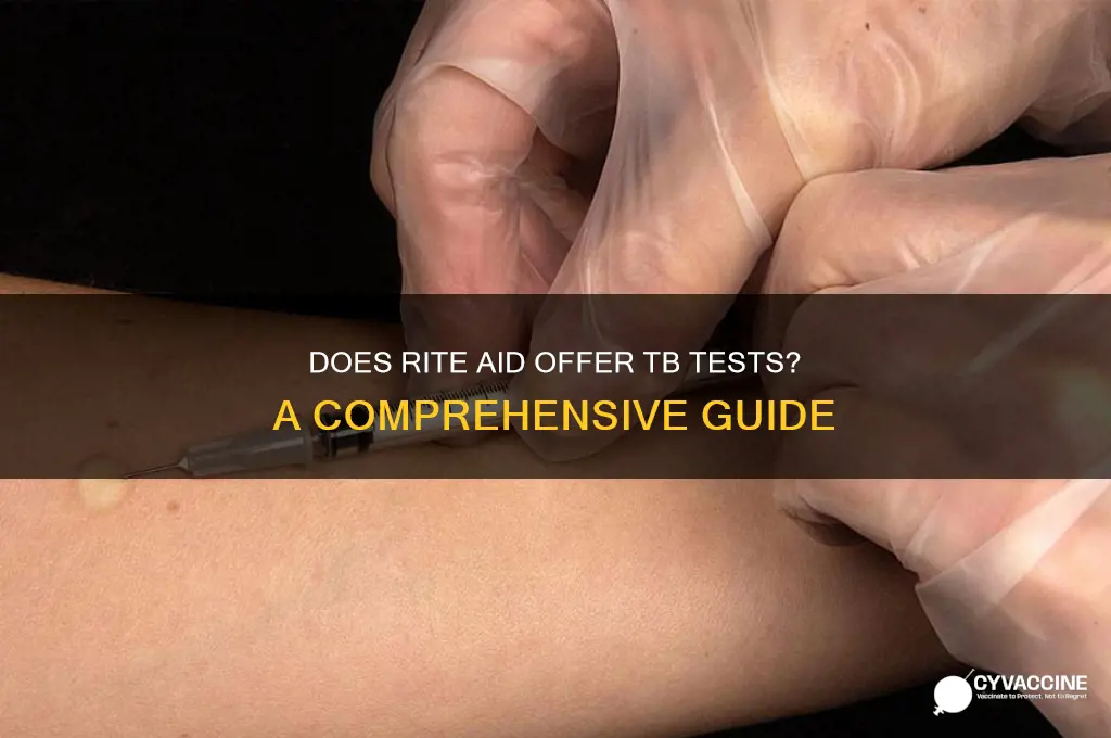 does rite aid do tb tests