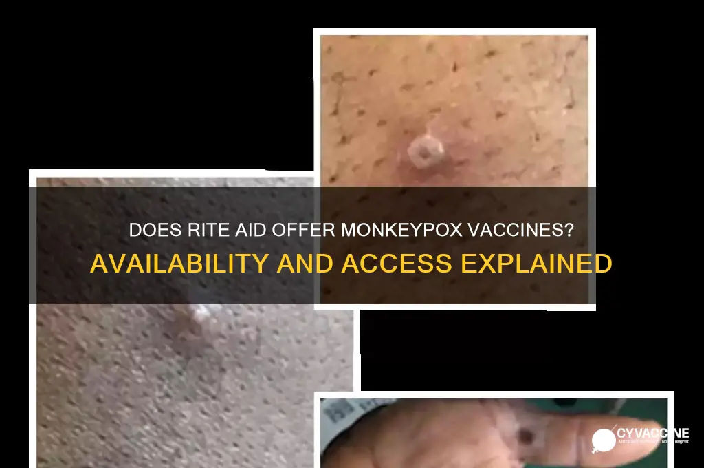 does rite aid have monkeypox vaccine