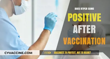 Can COVID-19 Vaccination Cause a Positive RT-PCR Test Result?