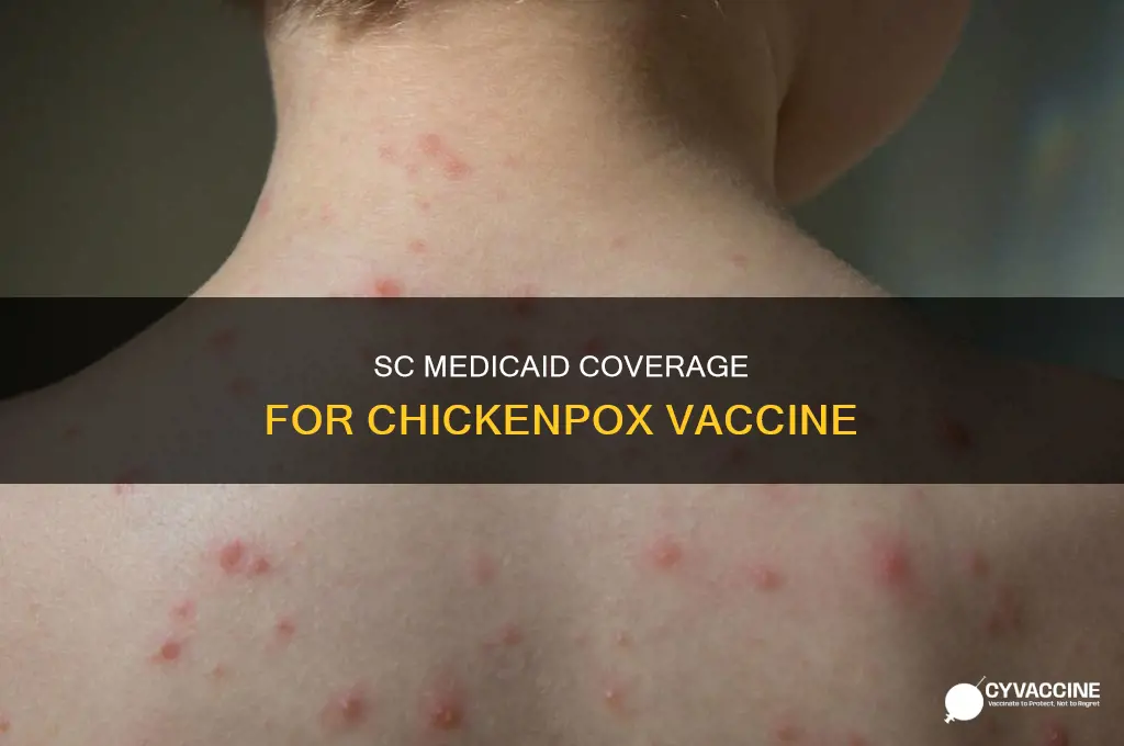 does sc medicaid pay for chicken pox vaccine