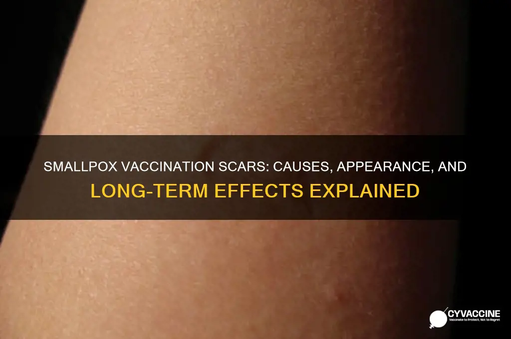 does smallpox vaccination leave a scar