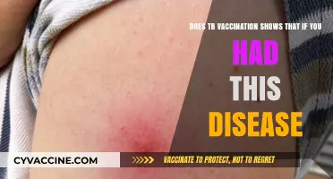 TB Vaccination: Past Infection or Protection?