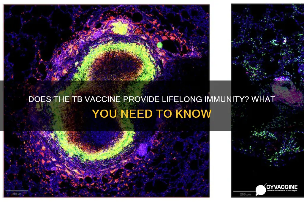 does tb vaccine last for life