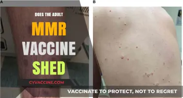 Does the Adult MMR Vaccine Shed? Facts vs. Myths Explained