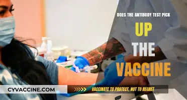 Antibody Test: Can It Detect Vaccination?