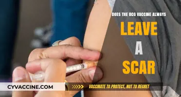 BCG Vaccine: Why Does It Leave a Scar?