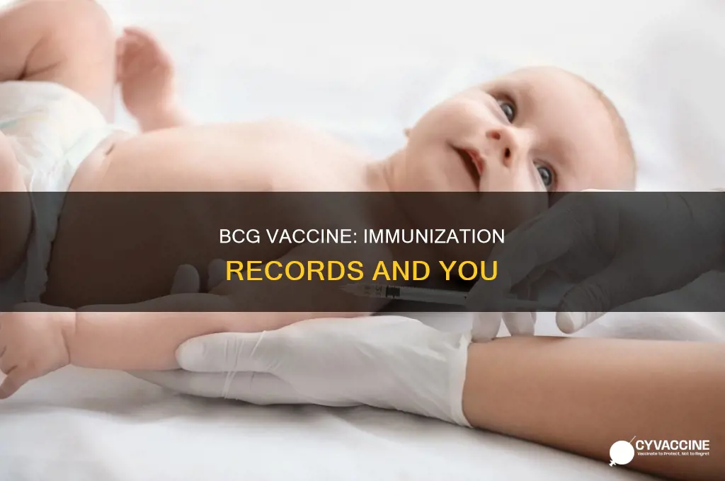 does the bcg vaccine show on immunization records