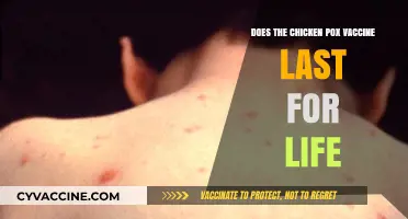 Chicken Pox Vaccine: Lifetime Immunity or Not?