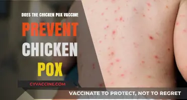 Chicken Pox Vaccine: Effective Prevention or Not?