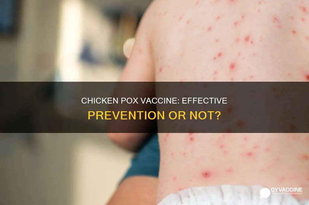 does the chicken pox vaccine prevent chicken pox