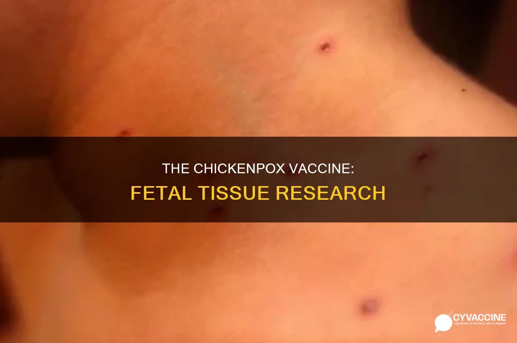 does the chickenpox vaccine come from aborted fetus