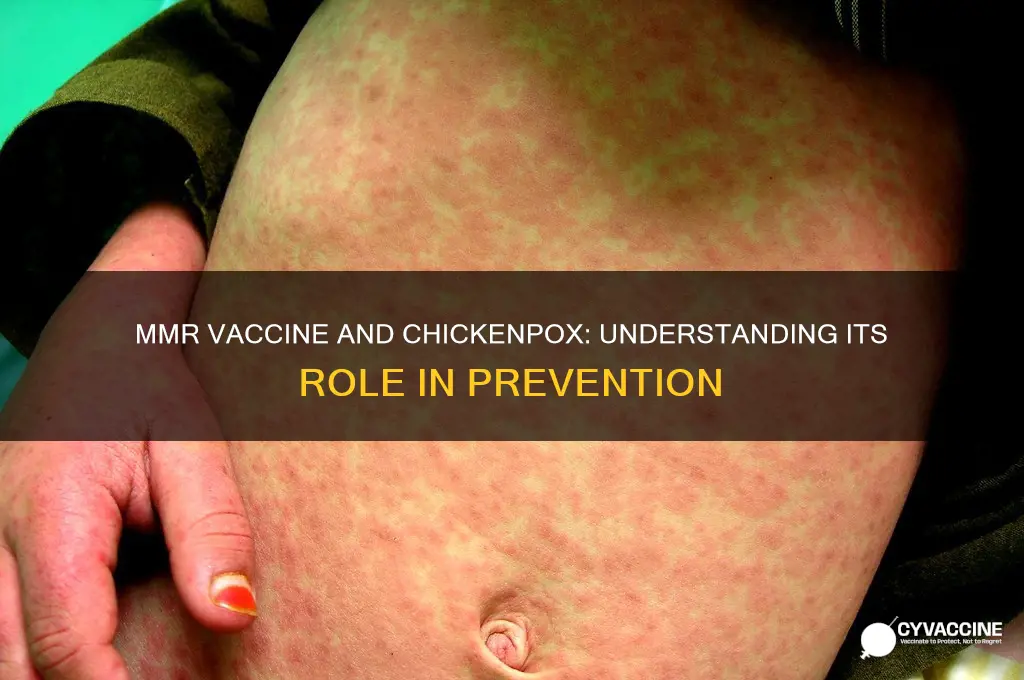 does the mmr vaccine prevent chickenpox