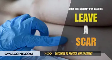 Monkeypox Vaccine: Scar Concerns and Facts