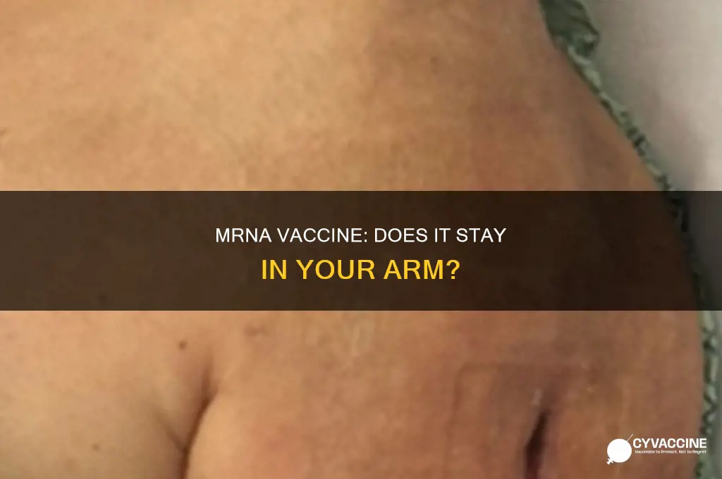 does the mrna vaccine stay in your arm