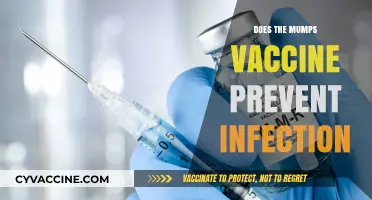 Mumps Vaccine: Does It Truly Prevent Infection and Outbreaks?