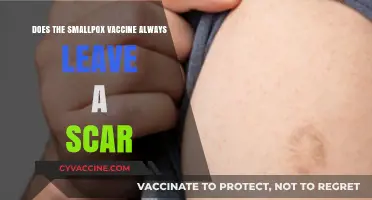 Smallpox Vaccine: Why Does It Always Scar?