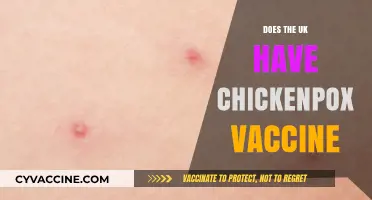 Is There a Chickenpox Vaccine Available in the UK?