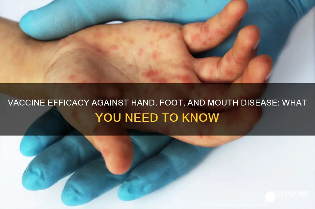 does vaccine help eith hand foot and mouth