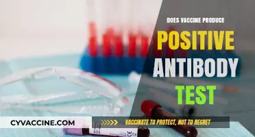Vaccines and Antibody Tests: Understanding Positive Results Post-Immunization
